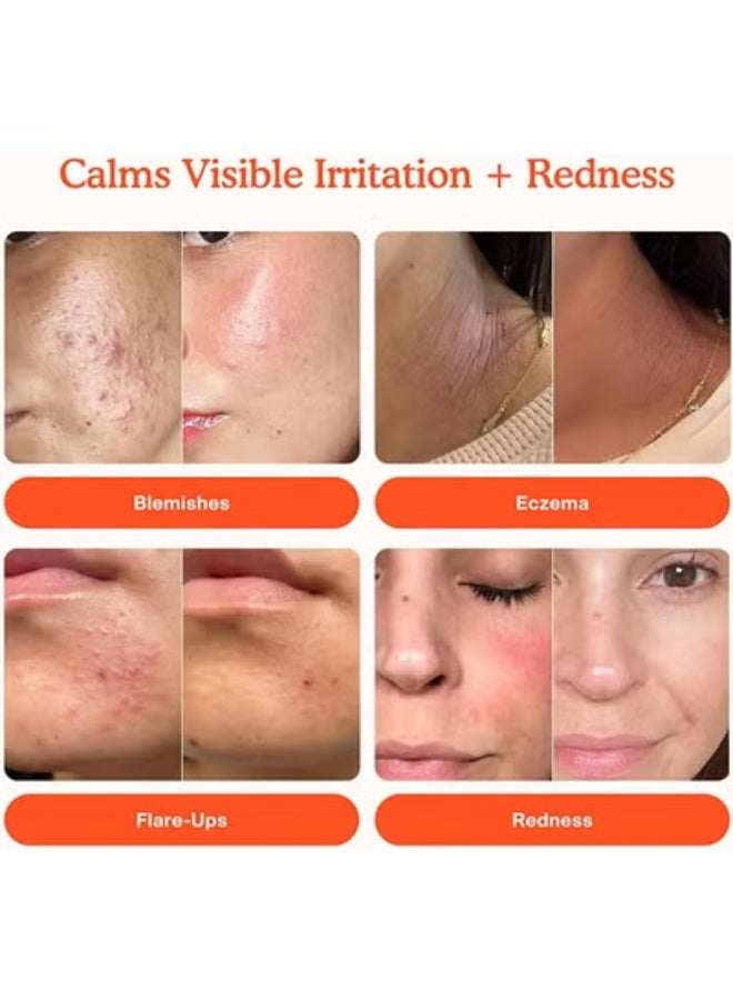 Tower 28 SOS Daily Rescue Facial Spray - The Miracle pH - Balancing Toner! Hypochlorous Acid Formula For Ultra - Sensitive Skin, Full Size Toner For Face, 4 Fl Oz - Image 2